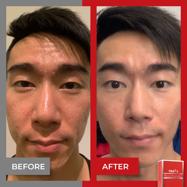 Justin Wong